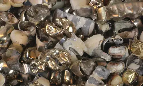 Dentalmaterial aus Edelmetallen für den Edelmetallankauf